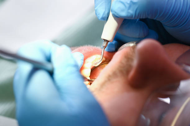 Best Pediatric Emergency Dentist in Lexington, OK