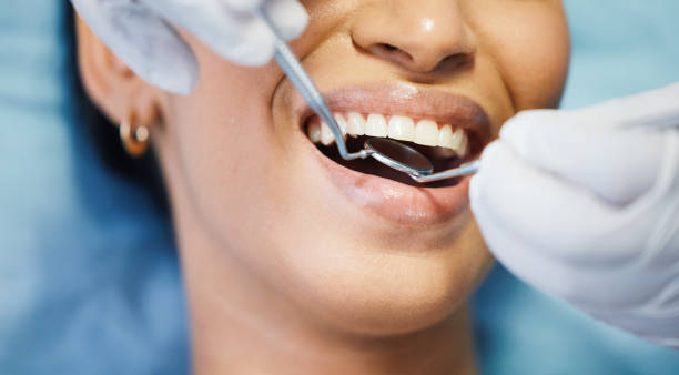 Best Emergency Treatment for Dental Infections or Abscesses in Lexington, OK